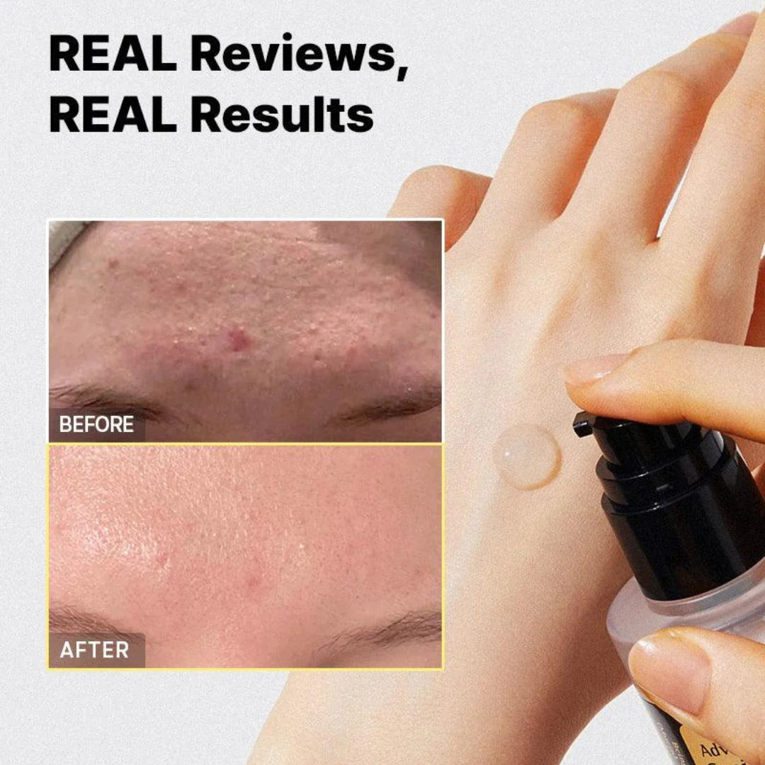 CosRx Advanced Snail 96 mucin Power essence 100 ML.