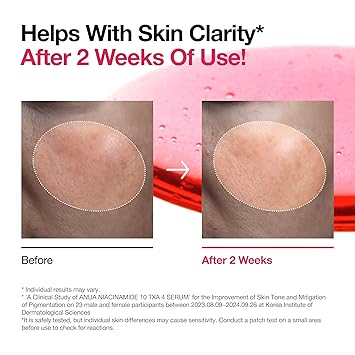 ANUA - NIACINAMIDE 10% + TXA 4% DARK SPOT serum