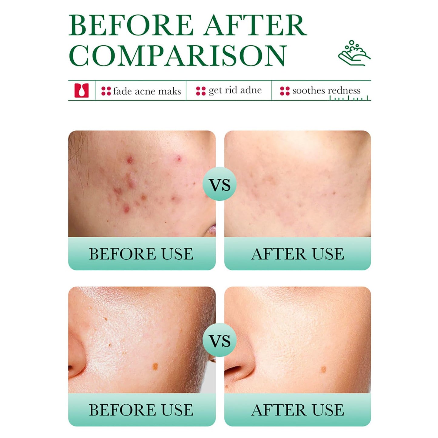 BIOAQUA Salicylic Acid Acne Removal Cleanser