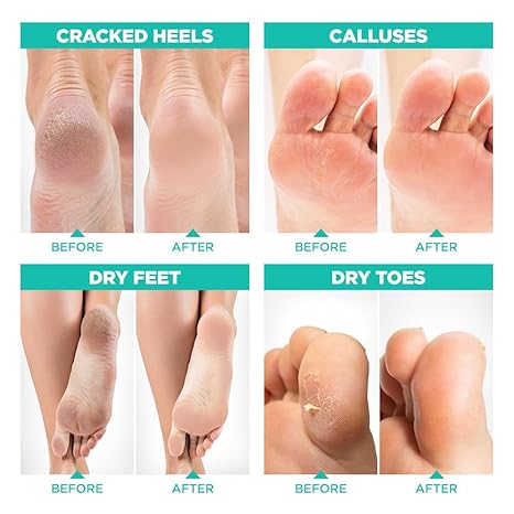 Gegemoon Foot Mask