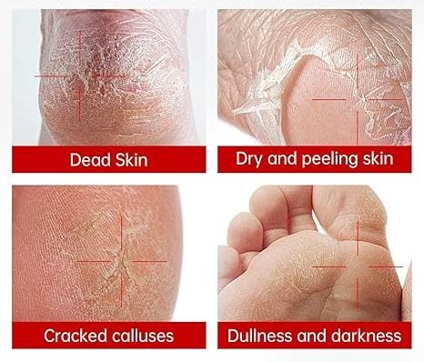 Gegemoon Foot Mask