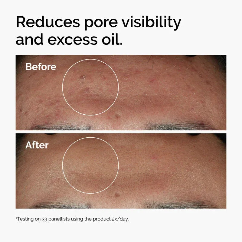 The Ordinary Niacinamide 10% Zinc 1% Serum 30ml