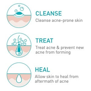 CeraVe Acne Foaming Cream Cleanser 150ml