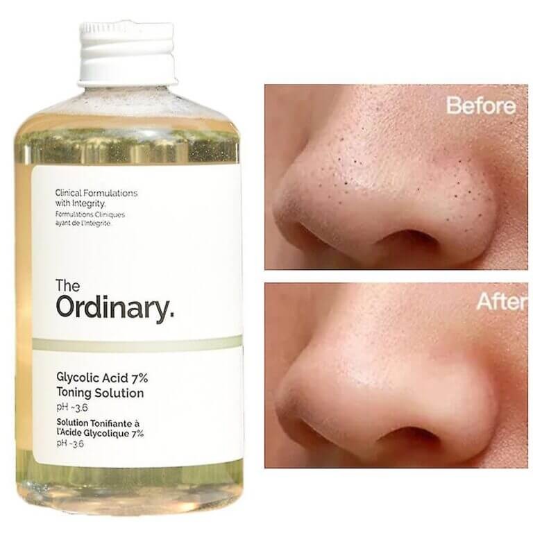 The Ordinary Glycolic Acid 7% Exfoliating Toner