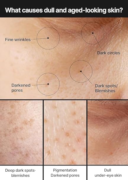 Celimax Pore + Dark Spot Brightening TXA Cream