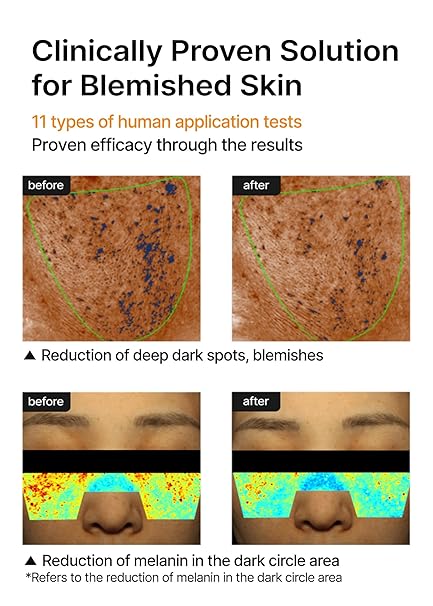 Celimax Pore + Dark Spot Brightening TXA Cream