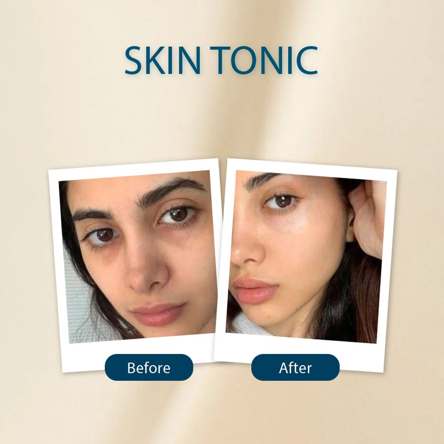 Soft Touch Skin Tonic